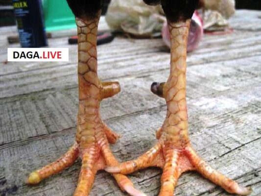 Khâu xác định đúng chỗ bị gãy giúp việc bó bột thuận lợi.