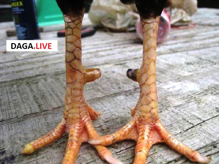 Khâu xác định đúng chỗ bị gãy giúp việc bó bột thuận lợi.