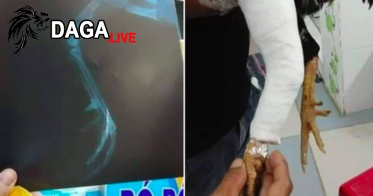 Tự điều trị hoặc mổ phẫu thuật