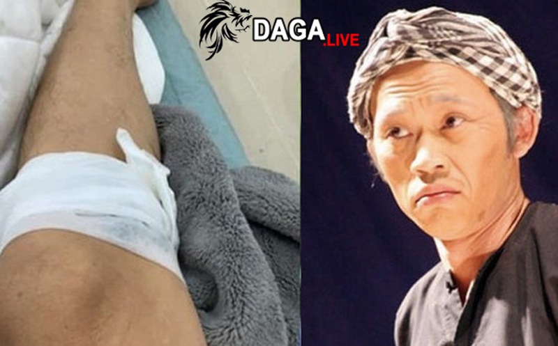 Tai nạn cười ra nước mắt của Hoài Linh với chú gà cưng